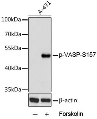 Western Blot: VASP [p Ser155] AntibodyAzide and BSA Free [NBP3-05448]